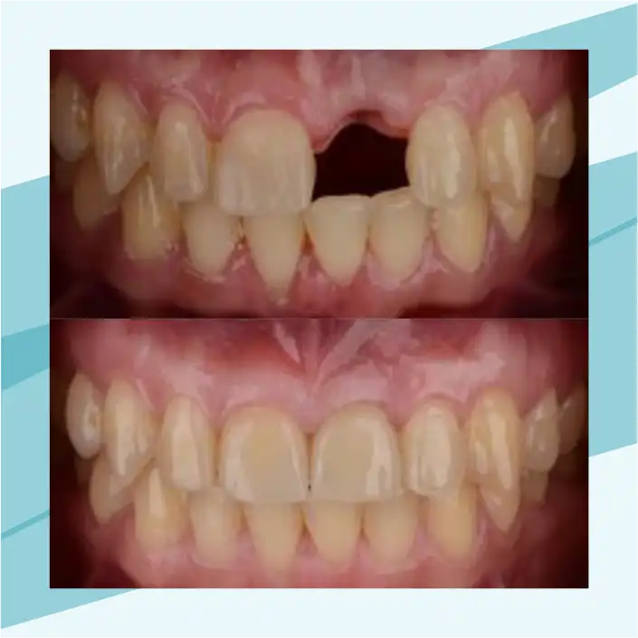 slide2