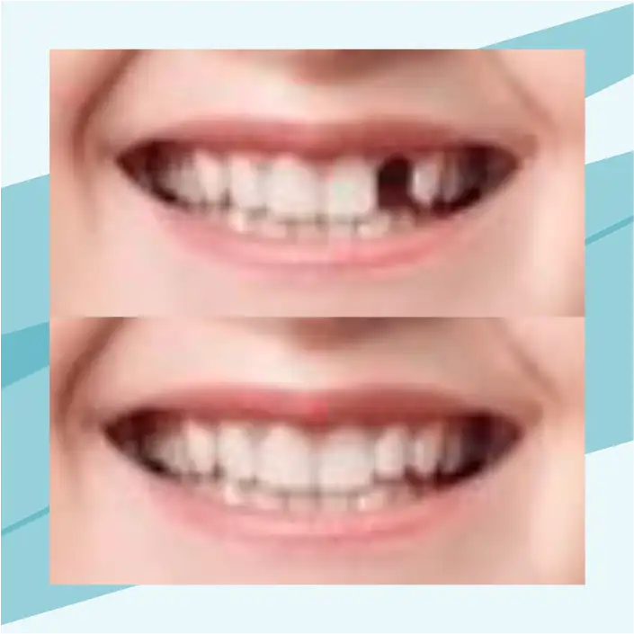 slide3