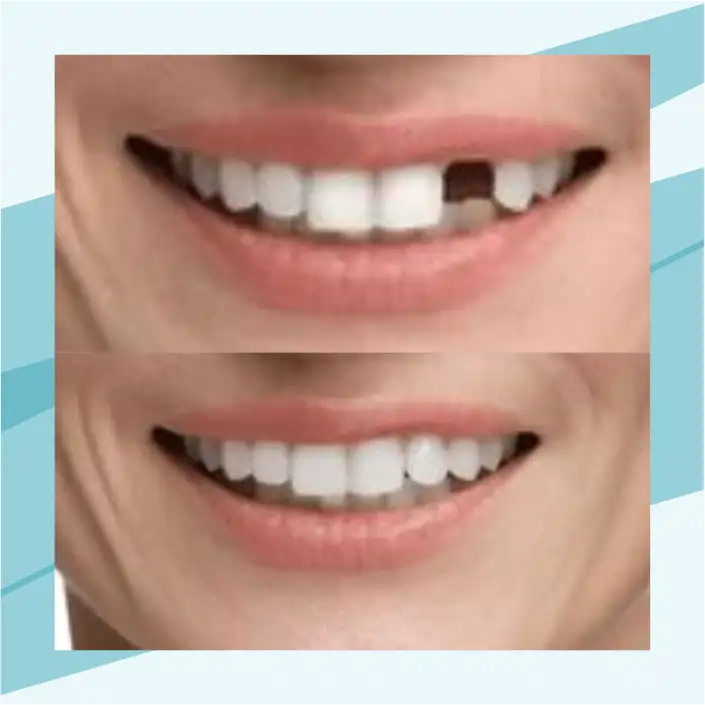 slide4