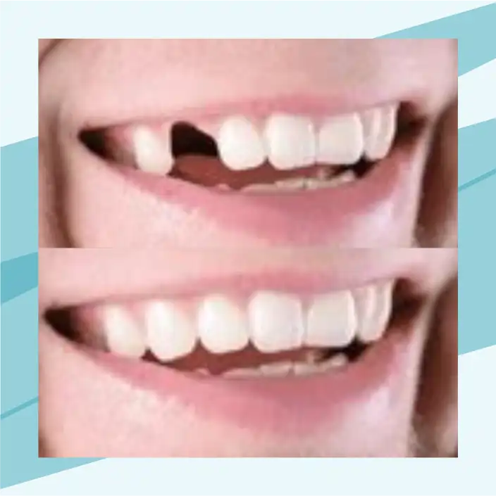 slide5