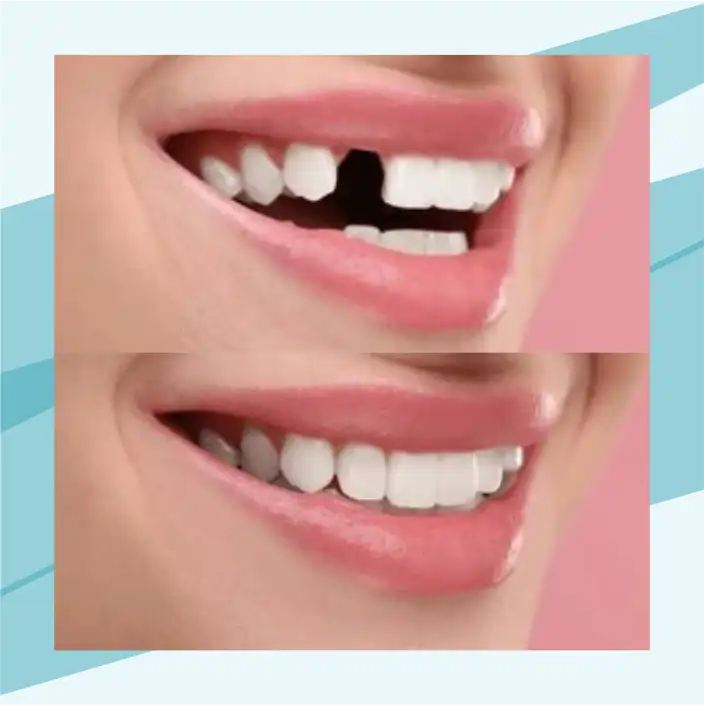slide6