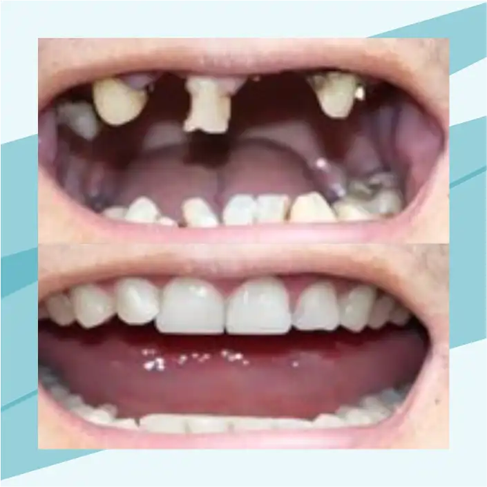 slide7